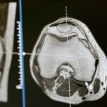 open MRI vs closed MRI