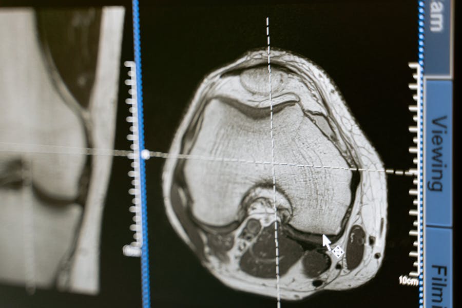 Open MRI vs Closed MRI: Pros, Cons, and Comfort Tips