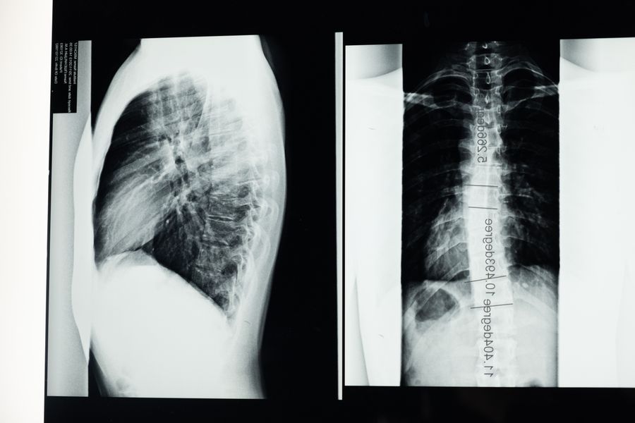 CT Scan vs X-Ray: When Doctors Choose Each Imaging Test